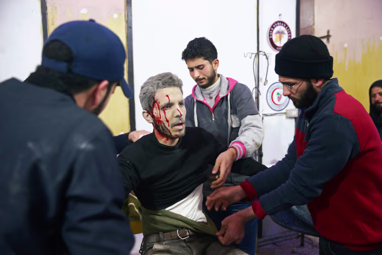 An injured man appears in shock while being treated in Douma on Feb. 20.