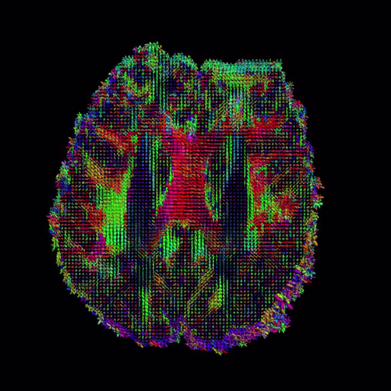 Image: Human connectome