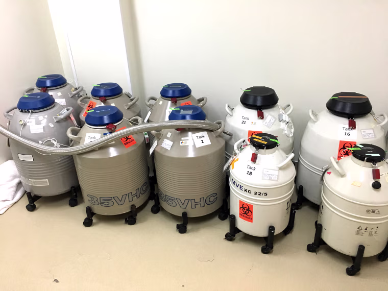 Fertility tanks without the new scale system.