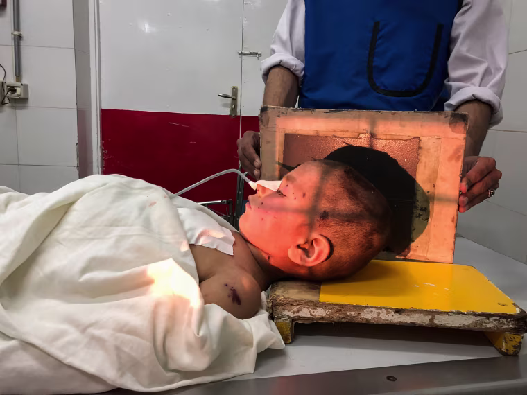 Image: Medical staff scanned Hedayat's head