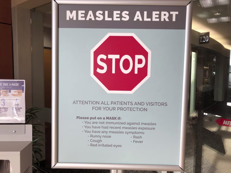 A sign posted at The Vancouver Clinic in Vancouver, Washington, warn patients and visitors of a measles outbreak