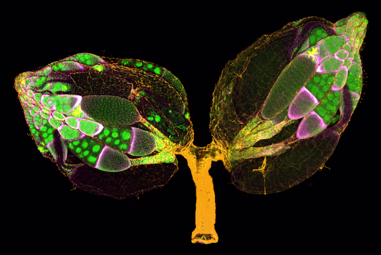 Image: Adult Drosophila Ovaries