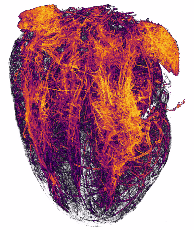 Image; Blood vessels of a murine (mouse) heart following myocardial infarction (heart attack)