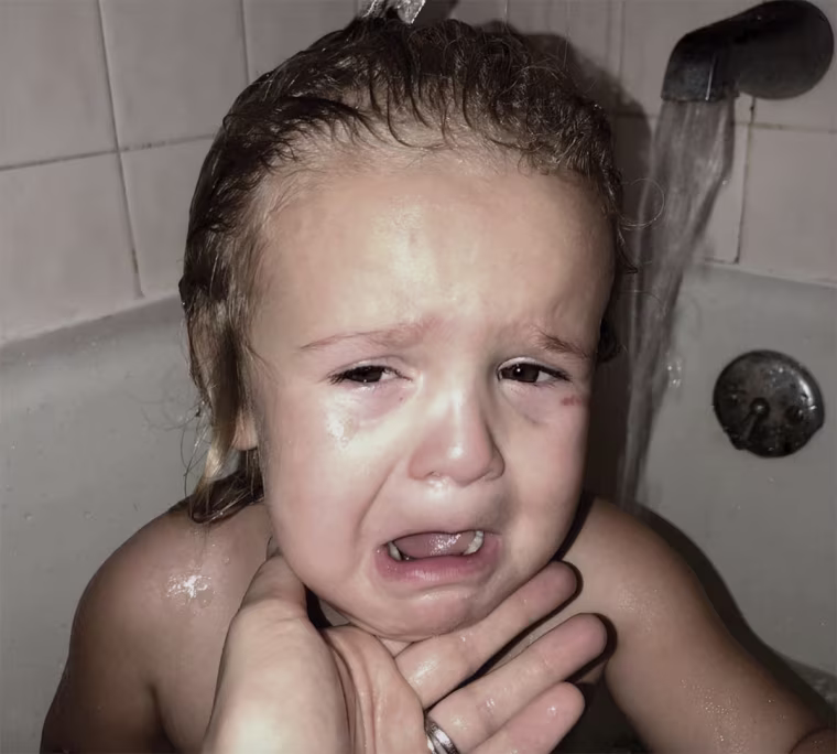 Charlotte had a gash on her face after she returned from foster care.