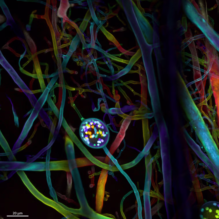 Multi-nucleate spores and hyphae of a soil fungus (arbuscular mycorrhizal fungus).