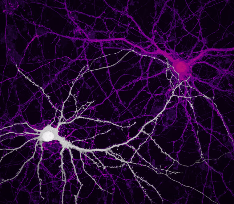Connections between hippocampal neurons.