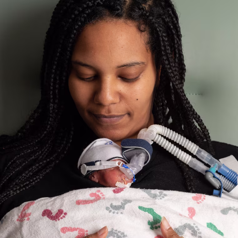 Helen Woldemichael delivered her daughter Amari at 25 weeks gestation.