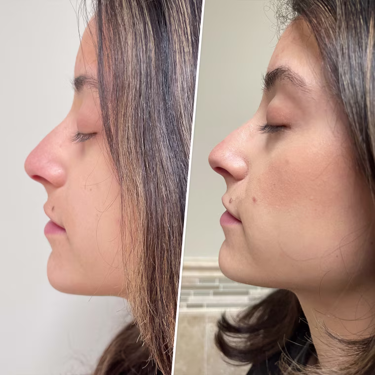 Before and After — Jill Ortiz using Lavish Lash serum