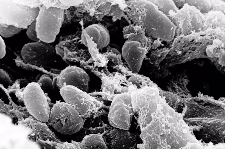 Yersinia pestis bacteria
