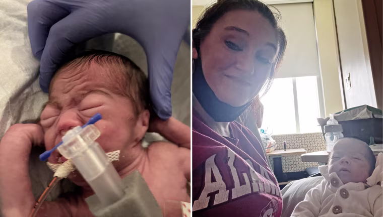 Mayron Hollis' daughter Elayna weighed one pound and 12 ounces when she was a newborn, left.