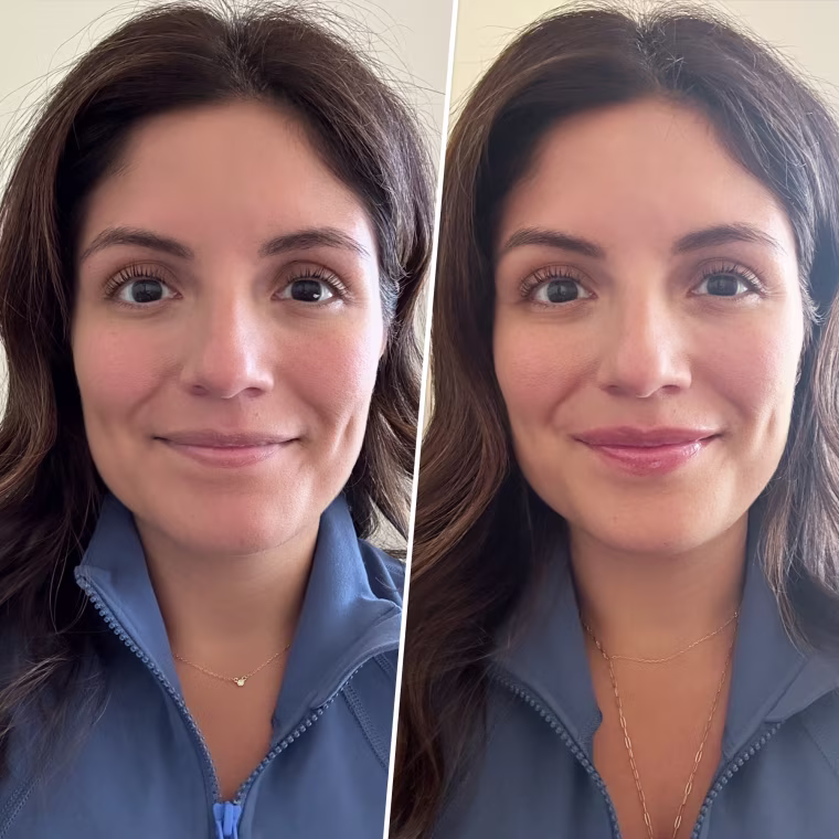 Shop TODAY Editorial Director Adrianna Brach tried it and says she definitely felt a tingle for a few minutes, but it's great for photos.