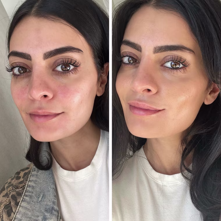 I wore three layers of the Supergoop SPF tint, which covered up my rosacea nicely.