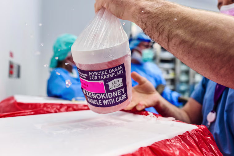A gene-edited pig kidney with thymus is removed from its transport container to be prepared for transplantation