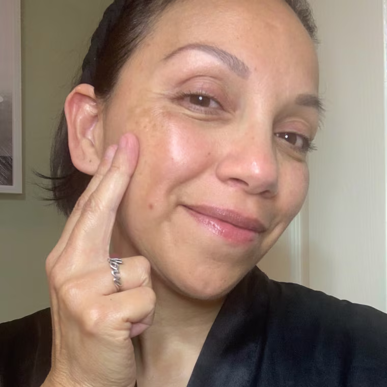 Applying the Differin Acne Treatment Gel