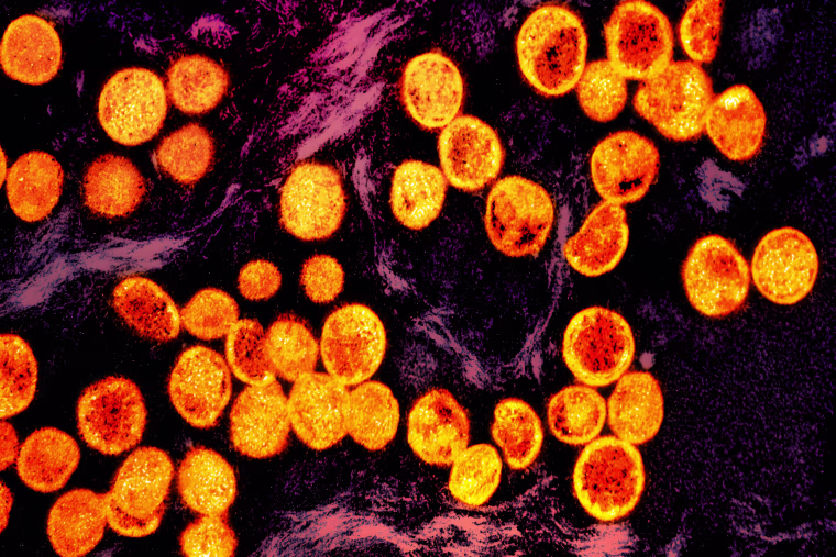 Transmission electron micrograph of monkeypox virus particles 