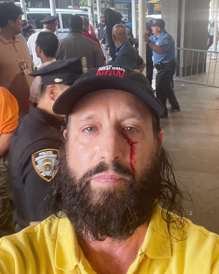  “I felt my eye, and then I saw blood," said Ben Goldies, who joined a small group of pro-Israel counterprotesters in front of Hunter College.