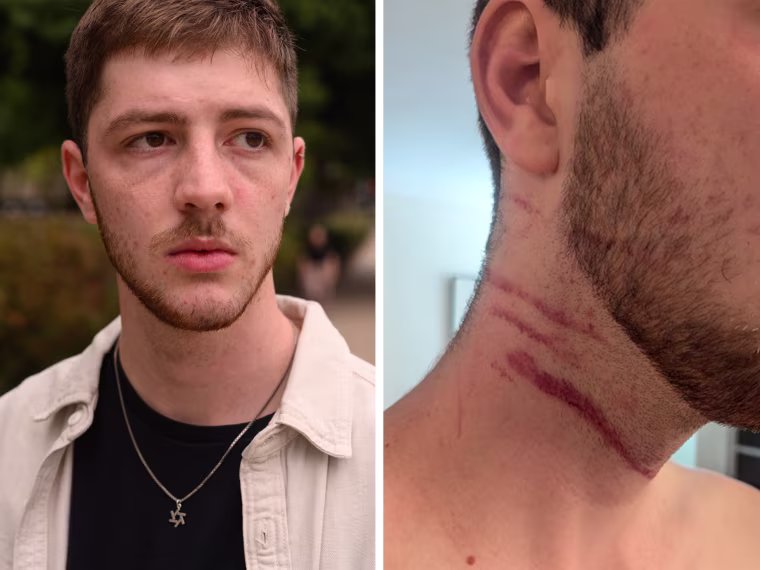  "I am struck on the back of my neck and the bottle shatters. Glass shards cut across my neck,” said Asher Goodwin.
