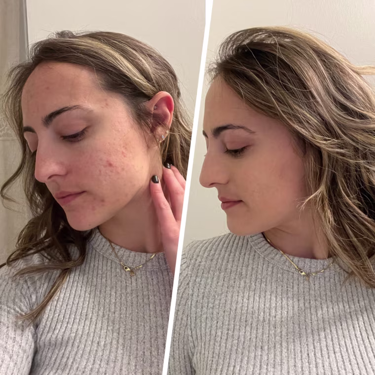 Il Makiage Woke Up Like This Flawless Foundation before and after application.
