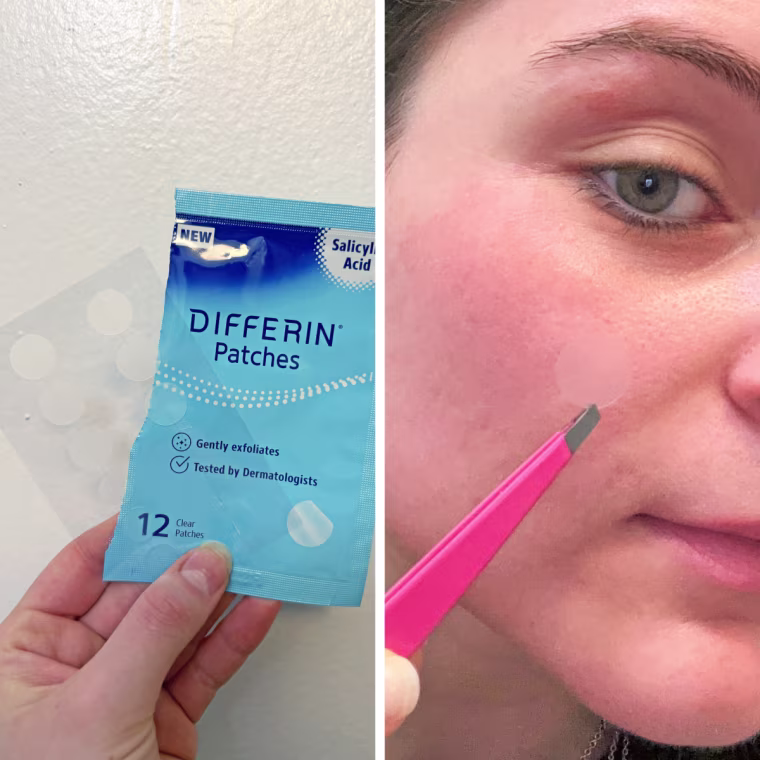 On the left, a woman holds the packaging and sheet of pimple patches in her hand. On the right, she uses tweezers to apply it to her skin.