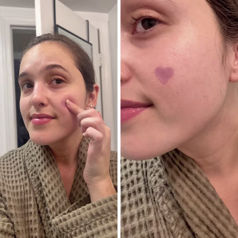 On the left, a woman applies a purple heart-shaped pimple patch to her cheek. On the right is a close up of the pimple patch on her skin.