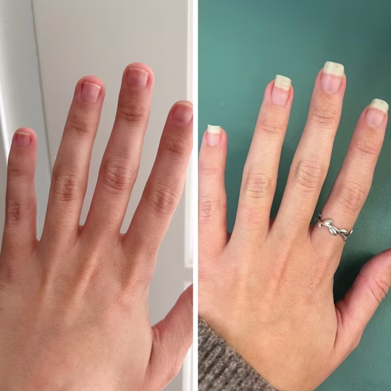 Before image of woman’s hand with short nails and after image of same woman’s hand with longer nails