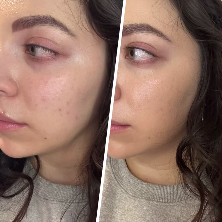 Before (left) and after (right)