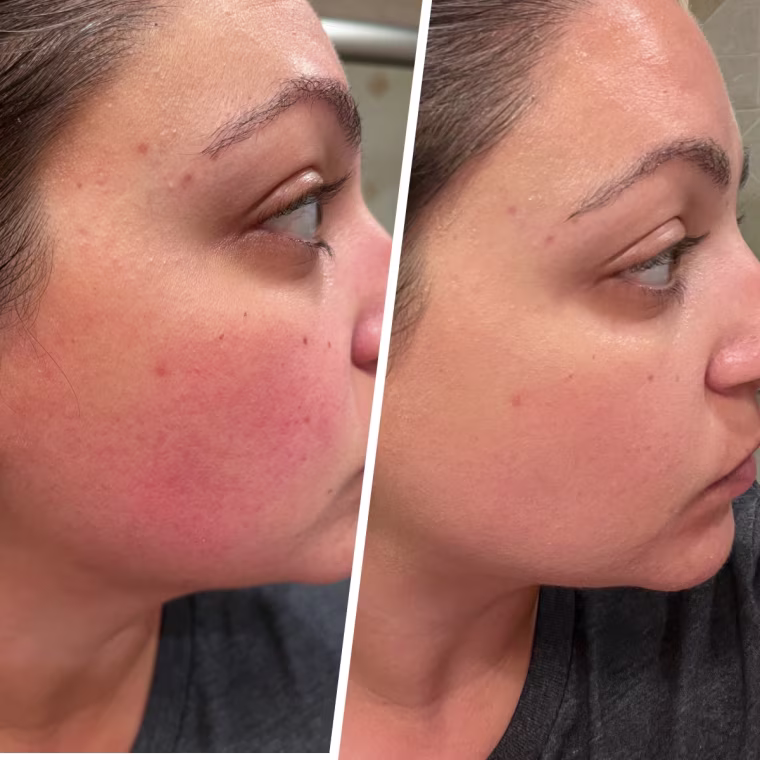 Producer Jillian Gonzalez trying the InnBeauty Project Calm The Red Down Dual-Chamber Serum.
