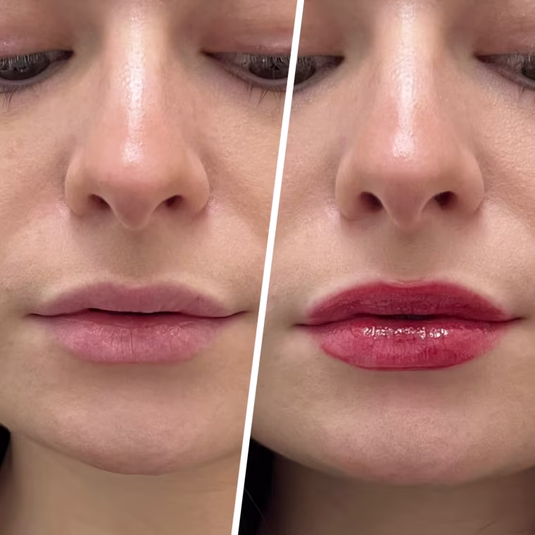 Production associate Audrey Ekman after applying the L.A. Girl Tinted Hydrating Lip Plumper.
