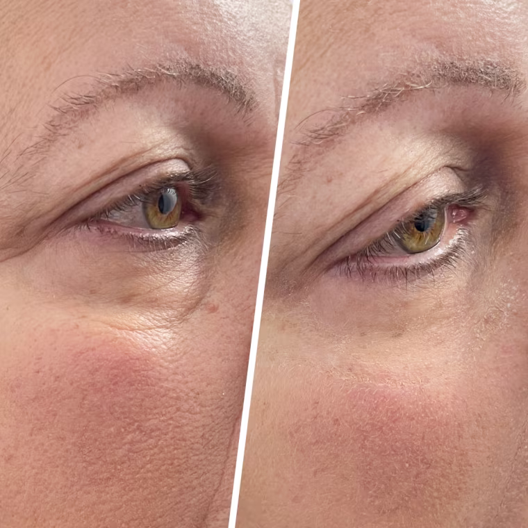 Janet Gonzales showing her results after using the Peter Thomas Roth Instant FIRMx Eye Tightener.