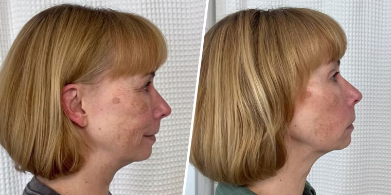 Before (left) and after (right)