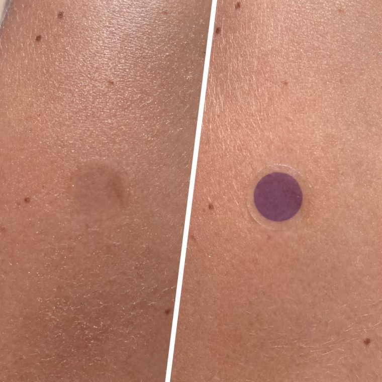 Before (left) and after (right)