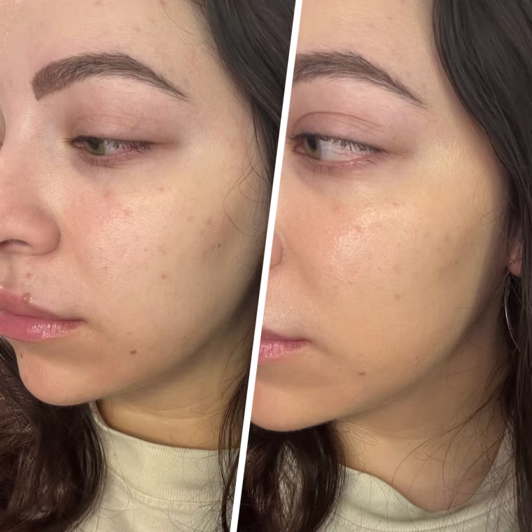 Before (left) and after (right)
