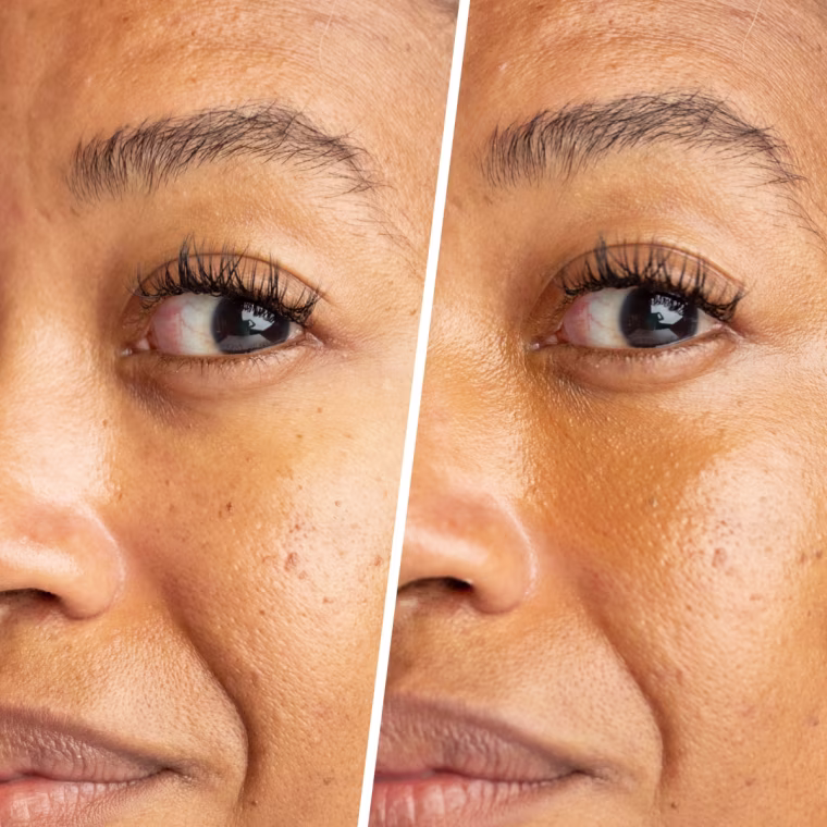 Before and after applying the It Cosmetics Do It All Radiant Concealer under the eyes.