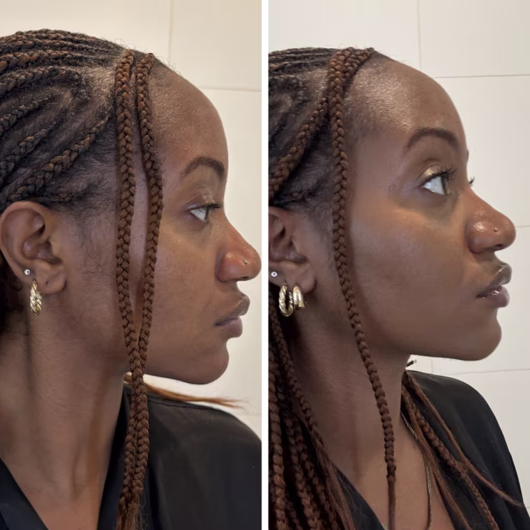 Before and after of woman wearing no makeup and same woman wearing LYS foundation