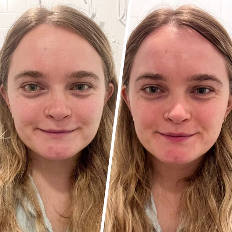 Before and after using the NuFace Mini Classic. 