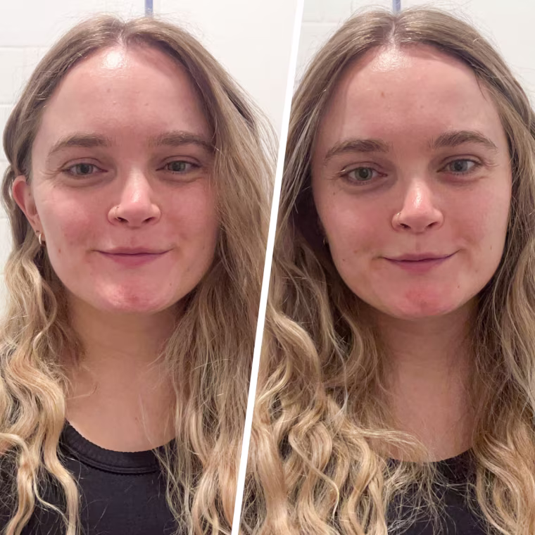 Before and after using the ZIIP Halo.