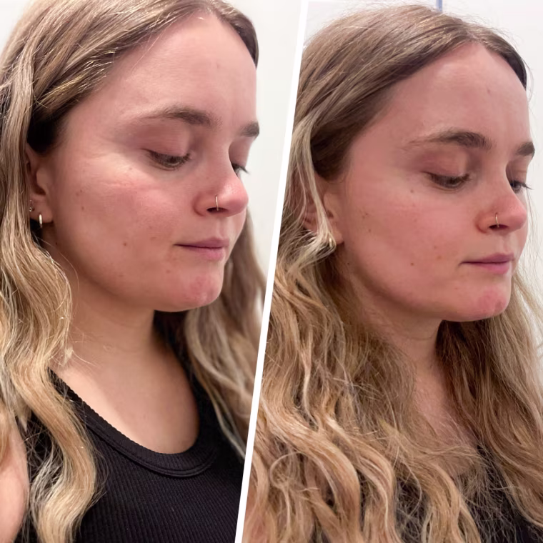 Before and after using the ZIIP Halo. 