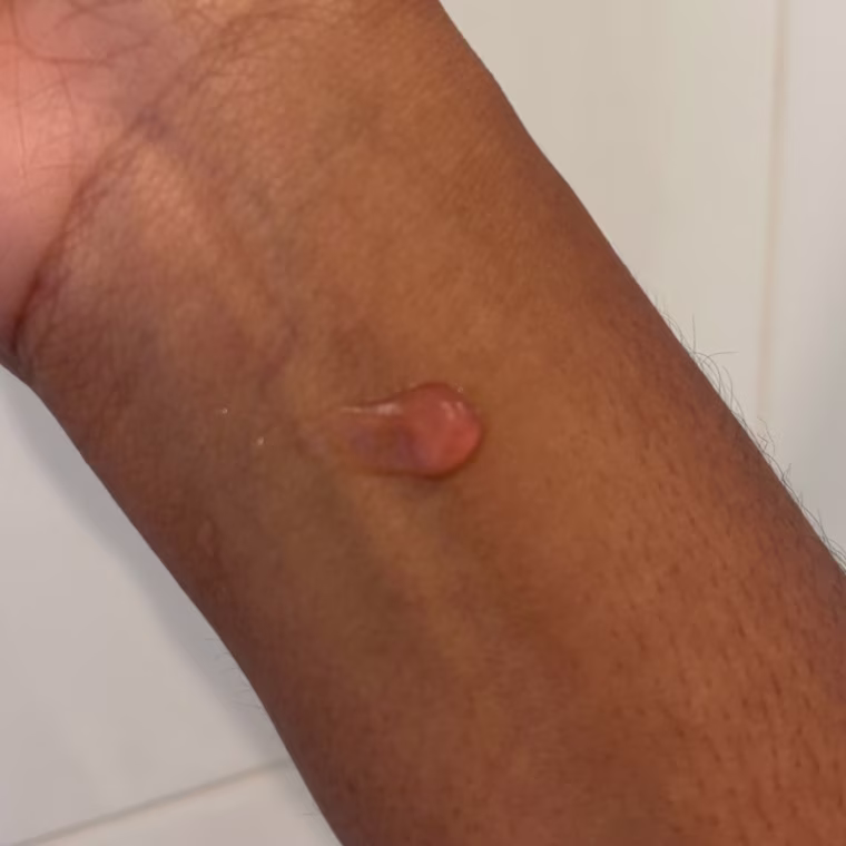 Dot of primer on woman’s arm