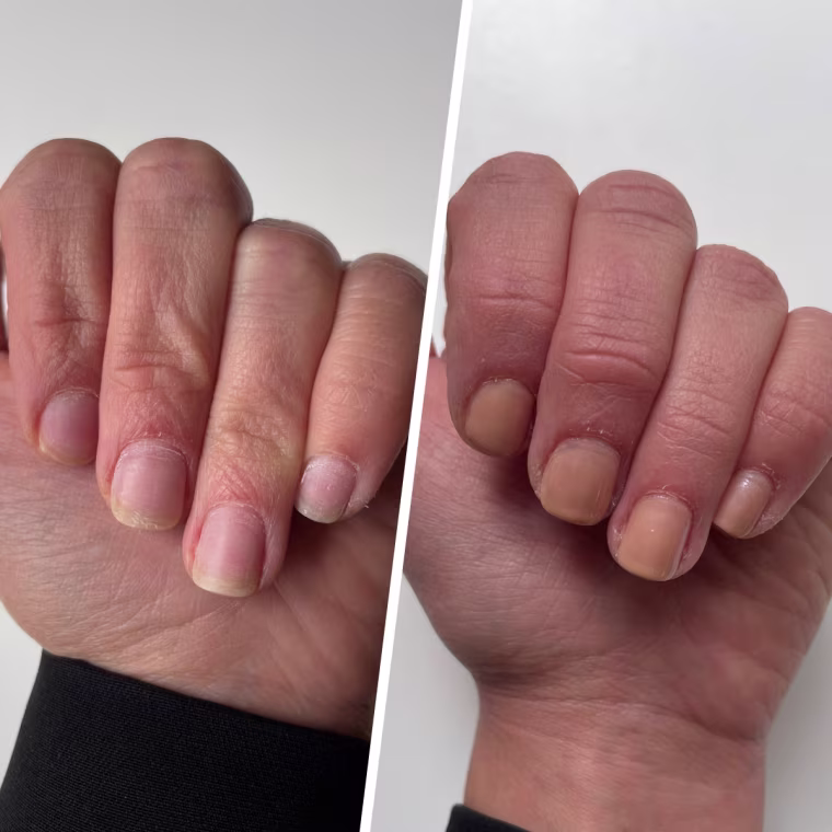 Before and after using LondonTown Kur Nail Concealer