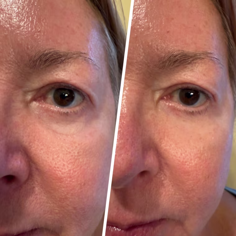 Peter Thomas Roth Instant FIRMx Eye Temporary Eye Tightener Before (left) and after (right)