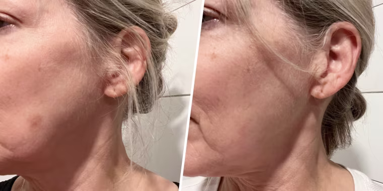 Hero Cosmetics Mighty Patch Micropoint for Dark Spots