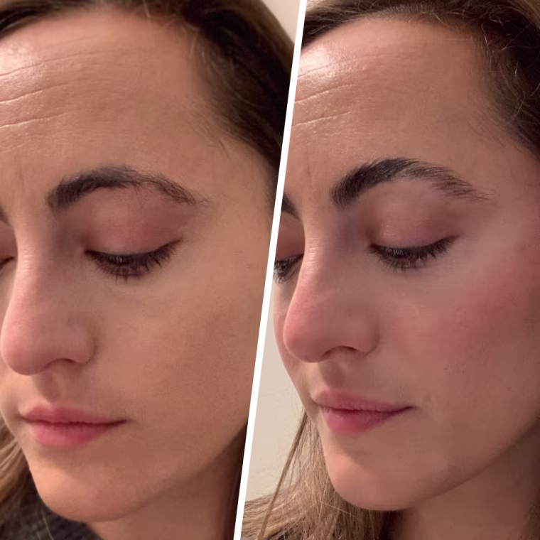 Writer Danielle Murphy before and after applying NYX's The Brow Glue.