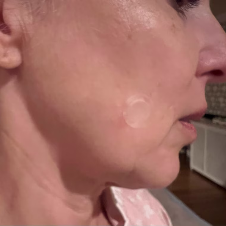Colleen Sullivan wearing the Hero Cosmetics Mighty Patch Micropoint for Dark Spots