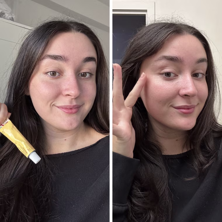 Cusacks with the Good Molecules Yerba Mate Wake Up Eye Gel unblended, and then blended under her eye.