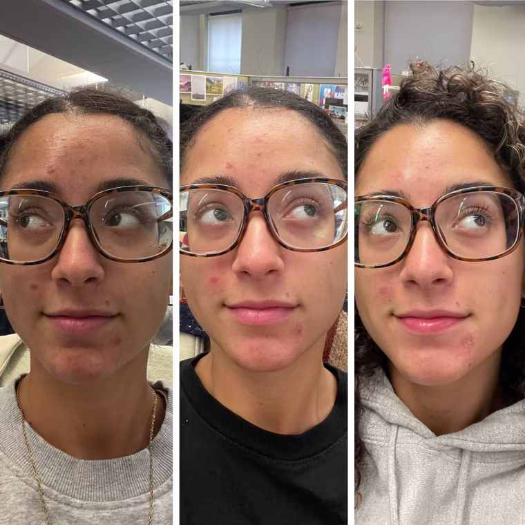 I could see the difference in as little as three days.