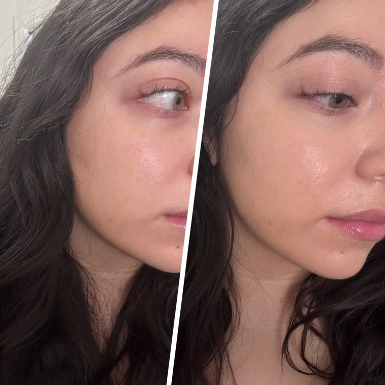 Before applying the Hourglass foundation (left) and after (right)