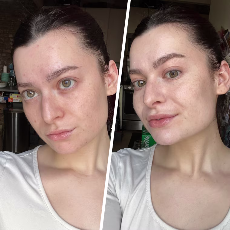Associate market editor Audrey Ekman before and after using the Milk Makeup Hydro Grip 12-Hour Hydrating Gel Stick Concealer.