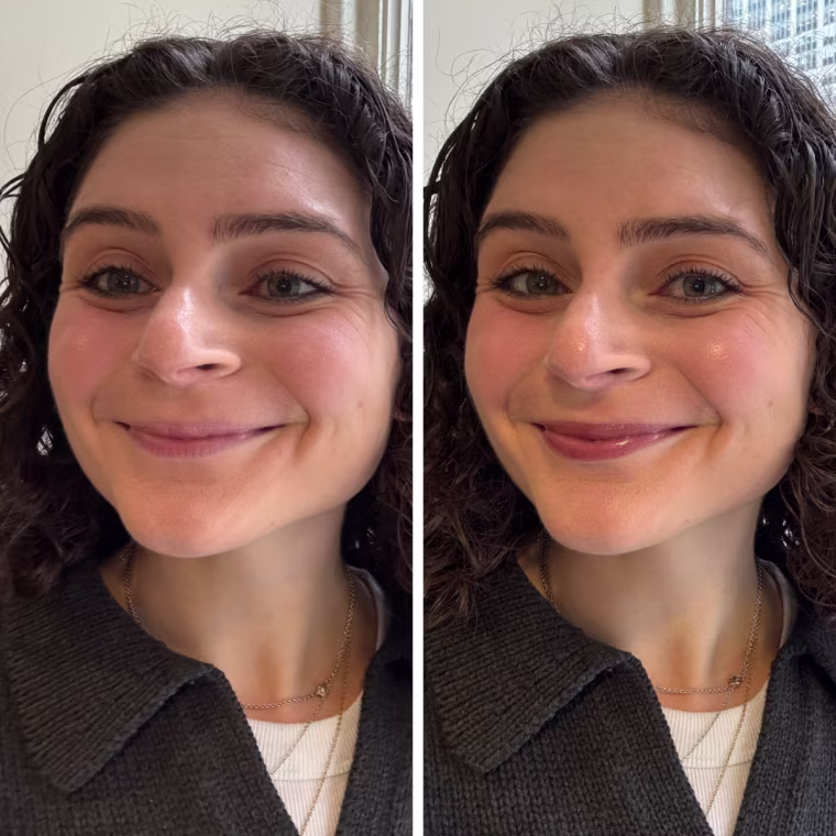 Before and after woman applying a plumping lip serum to her lips