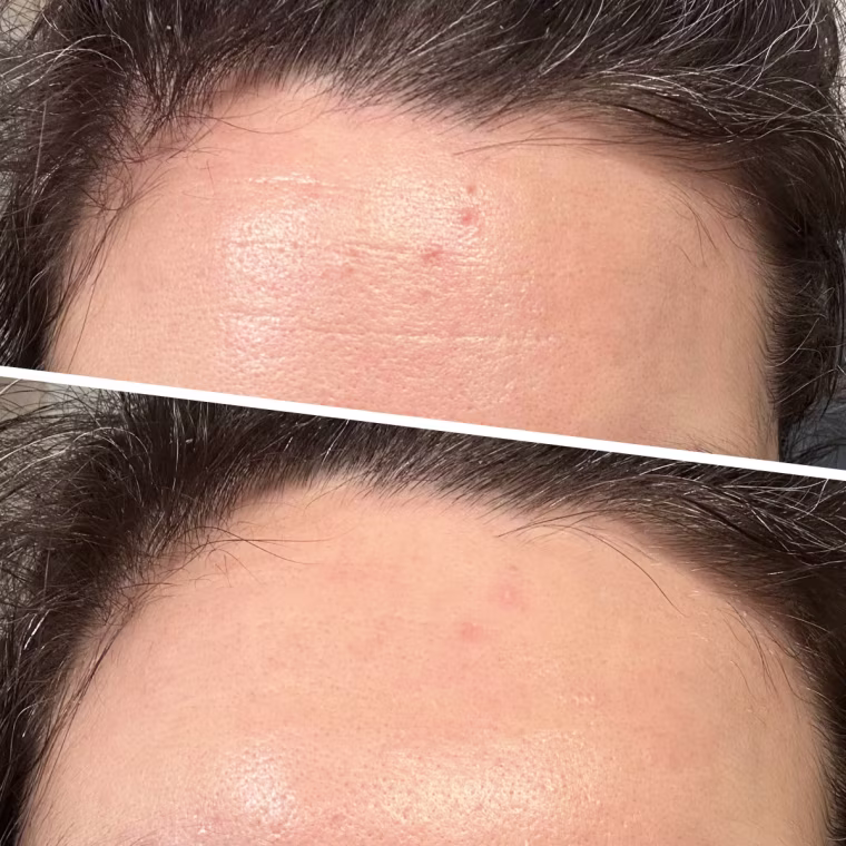 Ali Deabler, before and after using the Laura Geller Line Smoother Targeted Fine Line Blurring Primer