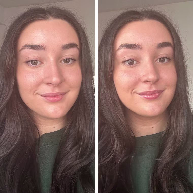 Before and after of woman applying a lip serum